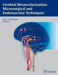 2405 Cerebral Revascularization Microsurgical And Endovascular Techniques Ebook Medical Library Free Ebooks Download