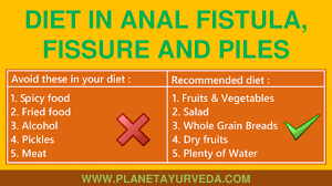 Diet Chart For Anal Fistula Fissure And Piles Patients