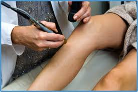 Why laser hair removal for dark skin is a big deal. Laser Hair Removal For Dark Skin