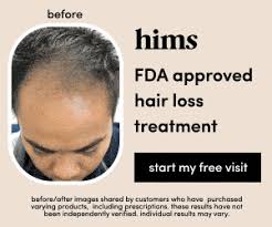 This supplement has proven to help in preventing hair loss which makes its use very popular. The 5 Best Vitamins For Hair Loss Prevention Based On Research