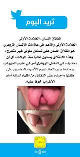 الإنسان، تركيب، الصور — جسم الانسان. Dr Q100 On Twitter Ù£
