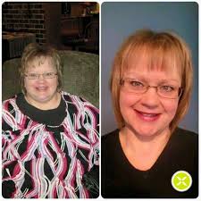 WOW.....A Game Changer for reaching Fibro Back Pain!