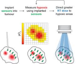 This formula is used to determine if you have. Real Time Measurement Of Tumour Hypoxia Using An Implantable Microfabricated Oxygen Sensor Sciencedirect