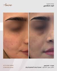 Anwar Issa Hasan (@dr_anwar_isaa) · Baghdad