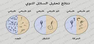 About press copyright contact us creators advertise developers terms privacy policy & safety how youtube works test new features press copyright contact us creators. Ø´Ø±ÙˆØ· ØªØ­Ù„ÙŠÙ„ Ø§Ù„Ø³Ø§Ø¦Ù„ Ø§Ù„Ù…Ù†ÙˆÙŠ Ø§Ù„Ø·Ø¨ÙŠØ¹Ù‰ Ù…Ù‚Ø§Ù„