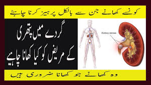 Avoid Food List And Diet Plan For Kidney Stone Patients In Urdu Gurdon Ki Pithari Ma Kya Khana Chahi Youtube