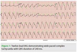 Image result for Flecainide