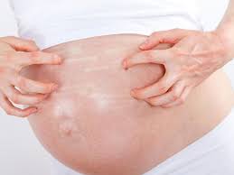 Itchy Skin During Pregnancy Babycentre Uk