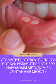 от чего запах изо рта и как от него избавиться Stomatit Rotovoj Polosti Vot Kak Izbavitsya Ot Nego Narodnym Metodom Za Schitannye Minuty Bez Kakih Libo Medikamentov Tovary Dlya Zdorovya Zdorove Travolechenie