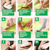 Foot complications are common in diabetic patients and are associated with a high amputation rate as well as being life threatening. 1