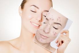 One of the easiest ways to get. 7 Homemade Natural Skin Bleach For A Bright And Beautiful Face Say Goodbye To Dull Skin The Urban Guide