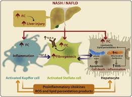 Recent Insights On The Role Of Cholesterol In Non Alcoholic Fatty Liver Disease Sciencedirect