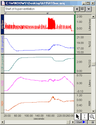Image result for Functional Residual Capacity