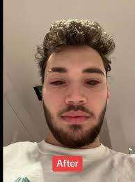 Adin Ross Looks at The Solar Exlipse