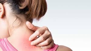 Hiv seringkali baru terdeteksi saat sudah memasuki tahap lanjut. Apakah Ruam Merupakan Gejala Hiv Kumparan Com