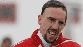 Franck ribery (born april 7, 1983) is a professional football player who competes for france in world cup soccer. Ribery Und Die Zahne Die Wurzel Allen Ubels Sport Sz De
