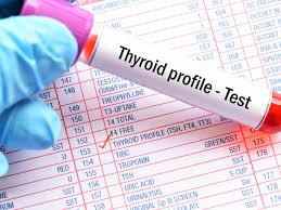 thyroid function test know what t3 t4 and tsh mean times