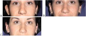 International Journal of Cosmetic Surgery