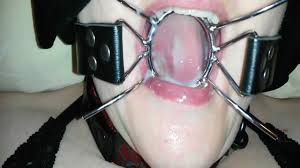 Ecarteur de bouche pour éjaculation buccale for...- BonPorn