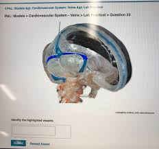 Solved Pal Models Gt Cardiovascular System Veins Gt Chegg Com