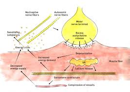 Trigger Point Therapy That Is How We Treat Pain