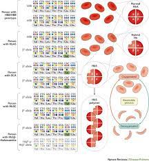 Sickle Cell Disease Nature Reviews Disease Primers