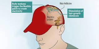 Wearing An Electric Hat Might Help To Reverse Baldness New Study