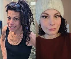 How rapid, seamless substance use treatment is changing lives at St. Paul's  Hospital