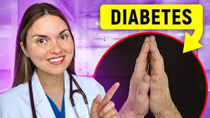 Your Health: Diabetes Education