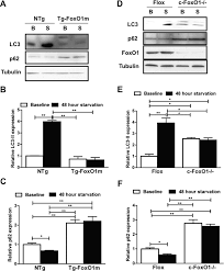 They can't chew through it. Deacetylation Of Foxo By Sirt1 Plays An Essential Role In Mediating Starvation Induced Autophagy In Cardiac Myocytes Circulation Research