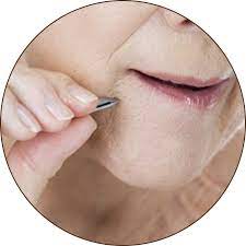 During puberty, androgens stimulate pubic and underarm hair growth in both men and women. About Menopausal Hair Growth Leicester Laser Clinic