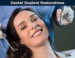 Dental Implants Burbank