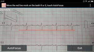 1) ensure that the watch is snug on your wrist and your arms are resting on a table. Ecg Reader Free For Android Apk Download