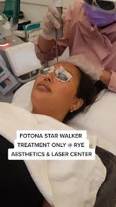 Tratamiento Fotona Star Walker en Rye Aesthetics