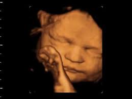 Sounds like you have a very active baby! 3d 4d Ultrasound At 31 Weeks Goldenview Ultrasound Youtube