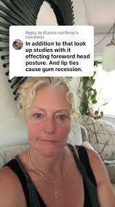 Replying to @Alanna northrop #tonguetie #newborn #reflux #sleepapnea  #newborncare #breastfeeding #bottlefeeding #pregnancyannouncement