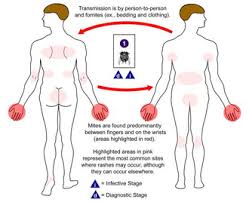 Image result for svrab na k%u016F%u017Ei