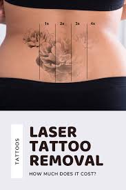 Here are a few landmarks to look for: Laser Tattoo Removal 3 Sessions