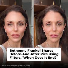 Bethenny Frankel Shares Before-And-After Pics Using Filters, 'When Does It  End?' 👉 https://diply.pub/3xoTDgp
