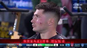 Lachlan Ilias of the South Sydney Rabbitohs is soooooo handsome #roscoe66  #footyplayers #NRL #rugbyleague #lachlanilias #southsydneyrabbitohs