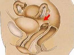 Image result for how to insert male organ into female organ