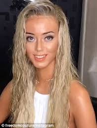 Perth model with Alopecia areata shares video of herself without a wig