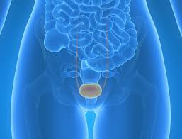 Image result for Bladder Cancer