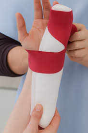 Image result for Radial Gutter Cast