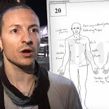 Chester Bennington Autopsy Report Released