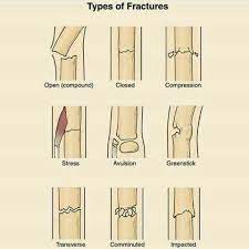 Pin By Dr Swismin Gems On Basic Medical Knowledge Medical Terminology Medical Knowledge Medical Education