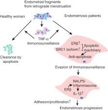 An early diagnosis, a multidisciplinary the main complication of endometriosis is impaired fertility. Endometriosis Sciencedirect