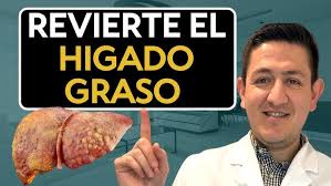 Hígado Graso QUE lo causa y COMO se REVIERTE Dr. Antonio Cota Sugar Care