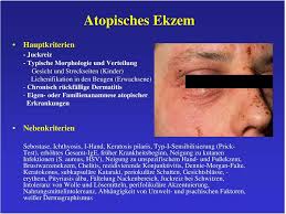 This condition is characterized by round or oval red patches. Entzundliche Dermatosen Pdf Free Download