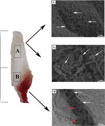 Your abbreviation search returned 61 meanings. The Effects Of Leukocyte Platelet Rich Fibrin L Prf On Suppression Of The Expressions Of The Pro Inflammatory Cytokines And Proliferation Of Schwann Cell And Neurotrophic Factors Scientific Reports